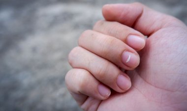 Tanda Putih di Kuku Bukan Pertanda Ada yang Rindu