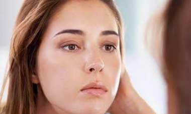 5 Kandungan Skincare Terbaik untuk Pemilik Kulit Berminyak