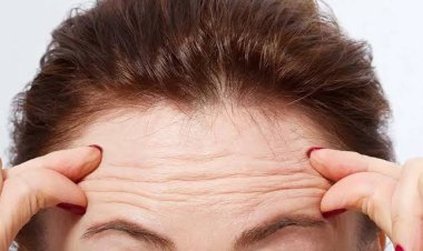 Berikut 5 Cara Cegah Kulit Keriput di Tengah Cuaca Panas