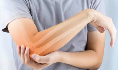 7 Tanda Tubuh Kekurangan Kalsium, Salah Satunya Bisa Merusak Gigi