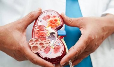 5 Cara Simpel Cegah Gagal Ginjal di Usia Muda, Mudah Tapi Masih Banyak Dilewatkan!