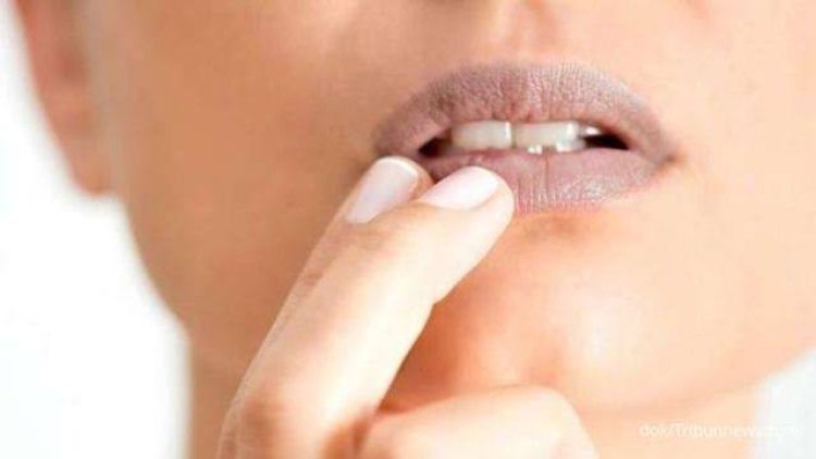 Berikut 6 Penyebab Bibir Berwarna Gelap, Waspada Masalah Kesehatan!