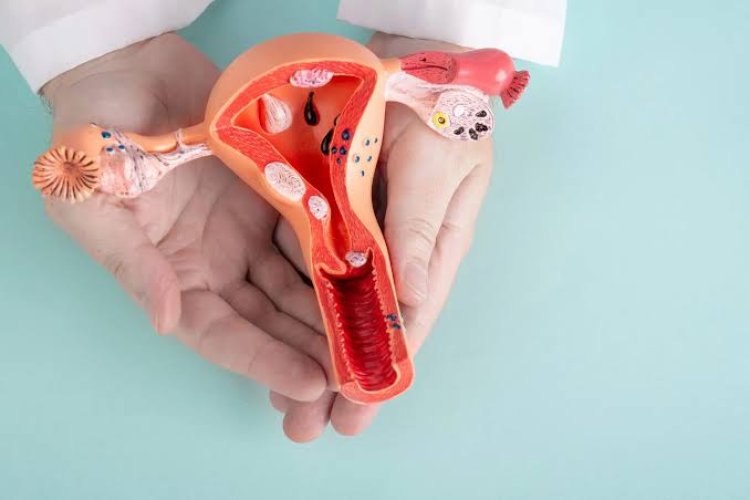 Waspada Kanker Serviks, Wanita Diimbau Manfaatkan IVA Test Gratis