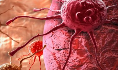 Tanpa Disadari, Cara Masak Bisa Picu Sel Kanker