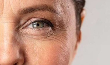 Ini Ciri-ciri Tubuh Kehilangan Kolagen dan Dampaknya bagi Kesehatan