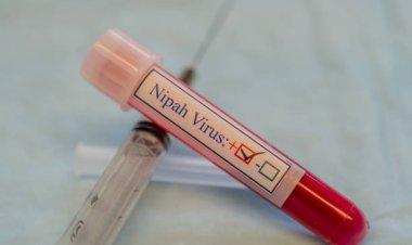 Virus Nipah Mematikan Muncul di India, Kemenkes Wanti-wanti Gejala dan Sumber Penularan
