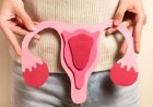 Gaya Hidup 'Kekinian' yang Tak Disadari Picu Kista Ovarium pada Usia Muda